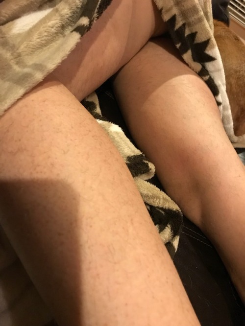 My wife has some really hairy toes.