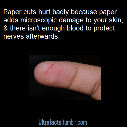 ultrafacts:  colourmeinterested:  ultrafacts:  For more posts like this, follow Ultrafacts