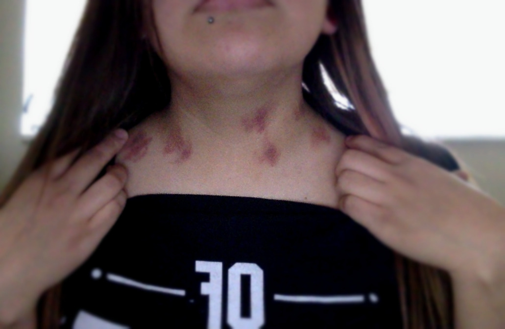 unicornsgomeoow:  Sooo.. this happened. :$ 