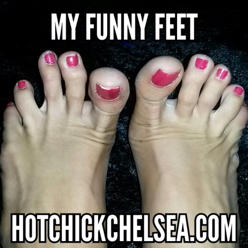 My Ugly Feet!