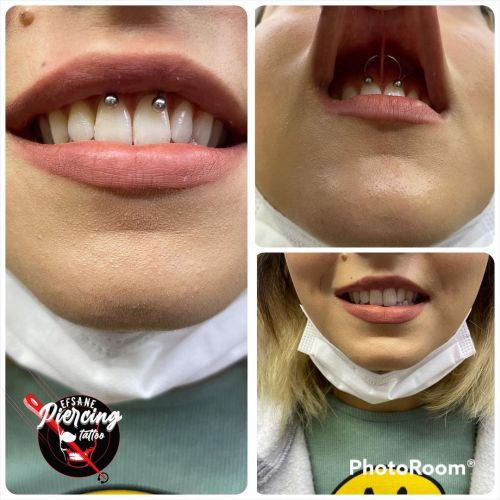 efsanepiercingtattoo:Smiley Piercing işlemi videolarımızı profildeki linki tıklayarak YouTube kanal