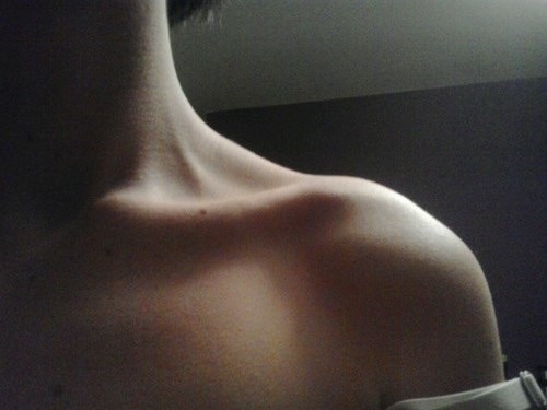 anti-anorexiant - collarbones are so beautiful