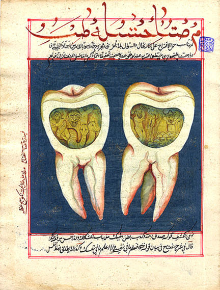 An 18th century hand-illustrated page from an Ottoman Turk dental book showing a molar infected with