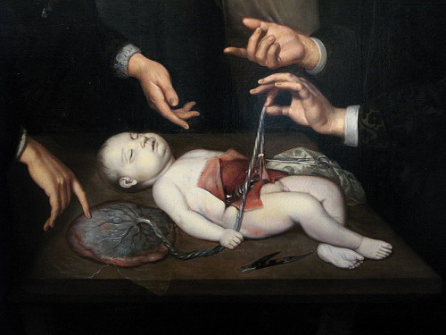 little-miss-scare-all666:Detail of The anatomy lesson of Dr. Frederik Ruysch by Jan van Neck, 1683