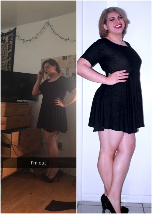 thelackofvaginamonologue: On the left pre-HRT, on the right about 2 months on HRT.I can see some lit