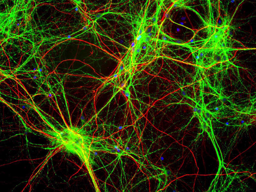 A Yin and Yang of Alzheimer’s DiseaseThe pathogenesis of Alzheimer’s (AD) disease is enormously comp