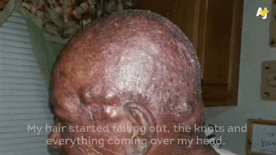 thingstolovefor:  U.S. Military Tested Chemical Weapons on WWII Soldiers by Race