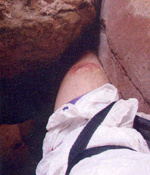 marianilima:  Photos taken by Aron Ralston, before and after he had to cut off his arm. 