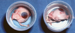 smellslikecadaverine:  Self-enucleation,