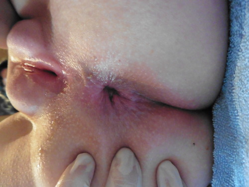itscyberskins:  whore-kira:  Arschfotze dehen   Swollen & open holes