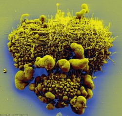 sixpenceee:  This alien-looking configuration is actually dividing cancer cells by Volker Brinkmann