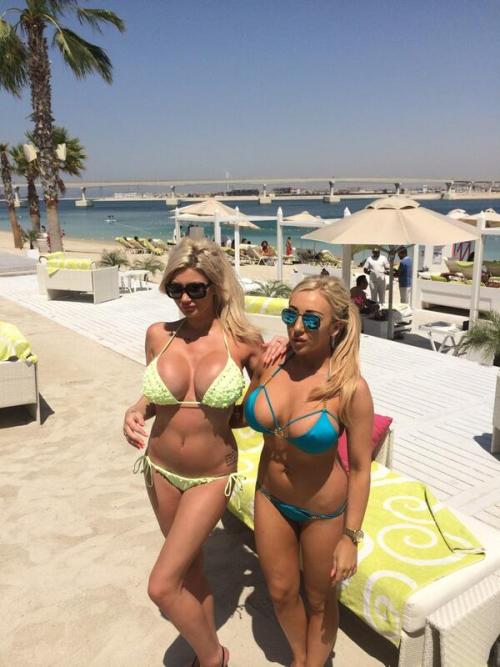 amateur-implant-pics:  DalzellSophie