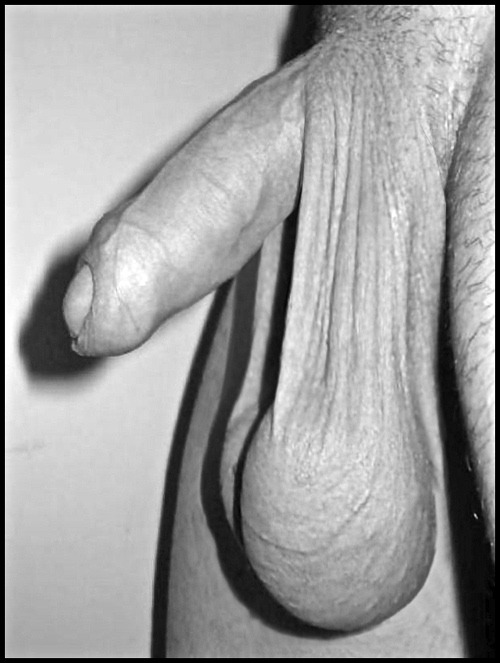 barebearx:  nick6520:  nick6520:  curlysuburban-urban:  abeautifulindiscretion:  Ballsy  Uncut  GREAT BALLS!!!!  what I would do with a pair of balls liketat, fuck„„„,  ~~~PLEASE FOLLOW ME ** ~~~~~~~~~ ♂♂OVER 38,500   FOLLOWERS   (Thank