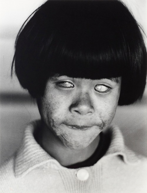 luciferlaughs - A girl blinded and disfigured by the atomic...