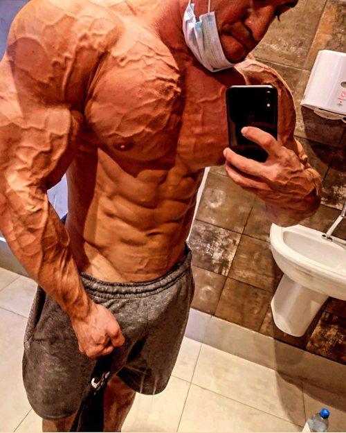 24 yo vascular IG: pedrovalenca6