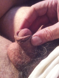 wetcock1:  davidmicro:  two finger tugging on my micropenis. i was at a crowded nude beach this summer and my tiny penis was the smallest out of hundreds of men. i paraded around with my inverted nub and was humiliated by dozens of women and well-endowed