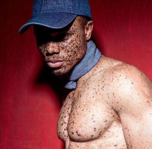 jourdepluie91:    It’s said a face without freckles is like a sky without stars 