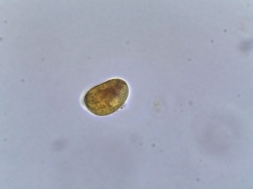 A rust disease urediniospores on bellflower (Campanula sp.).