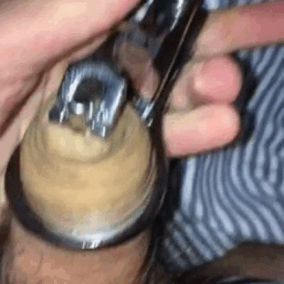 1in3-now-including-me:  It was fun to play, but now that foreskin is medical waste