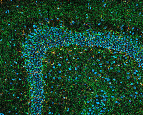 Rat brain, horizontal section | ZEISS Microscopy