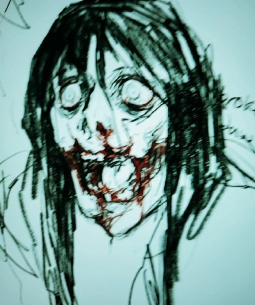 Broken Jaw