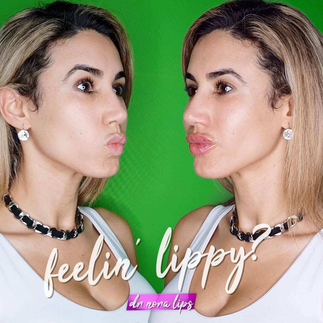 Whether you want big juicy lips or a heart shaped pout, Autumn is here, so it’s time to get lippy with Dr Nora ππ Treatment time is around 20 minutes and swelling and bruising is seen straight after which is expected to settle over 3-5 days. Wishing...