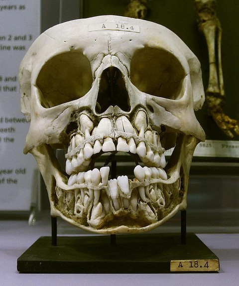 history1970s:  blackpaint20:  sovyetbritva:  Human child’s skull, before losing their baby-teeth. Hunterian Museum in London. Photo by Stefan Schäfer         