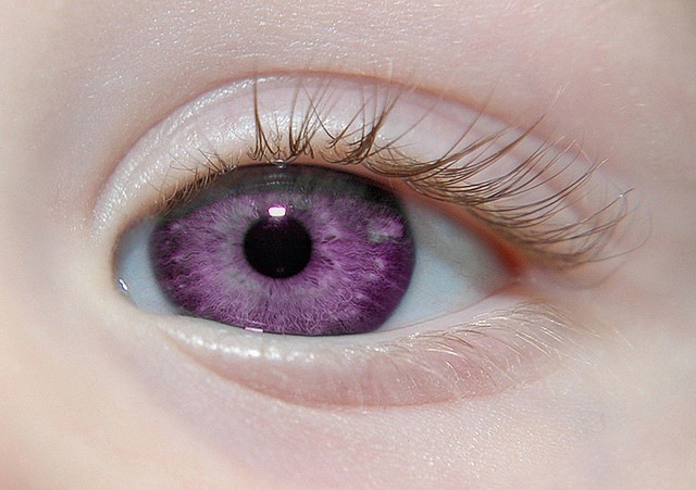 Alexandria’s Genesis, also known as ”violet eyes” (a mutation). &ndash;