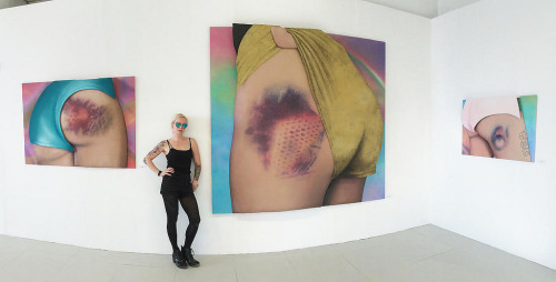 nevver:  Bruised, Rikka Hyvönen