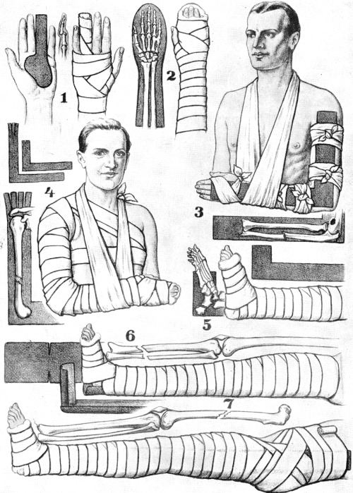 First aid bandaging techniques. Richards Topical Encyclopedia, 1962