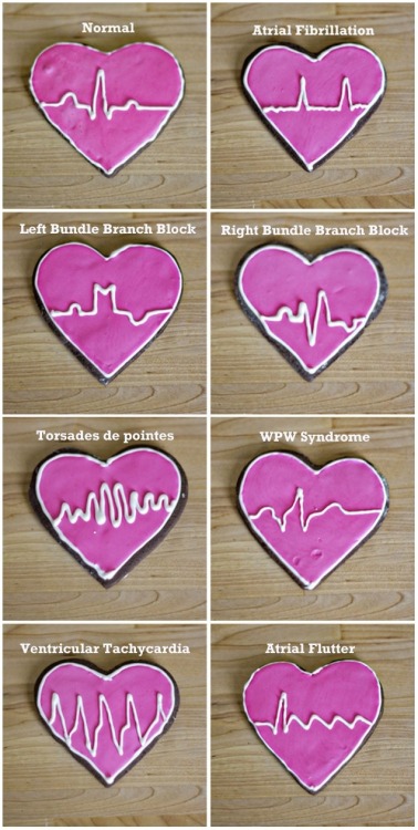 boyinthemachine:engineeringworldhealth:Heart beats, demonstrated via cookies.aisu cookies~