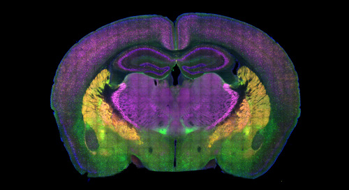 (Image caption: A cross-section of a mouse brain reveals some of the regions involved in the choice 