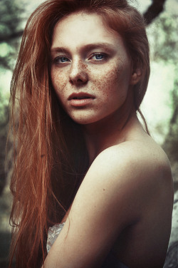 The story is, a redhead earns a freckle for every soul she steals.  This one has clearly been busy.