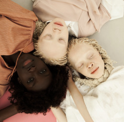 ouestsidee:  superselected:   Images.  Vinicius Terranova Showcases the Beauty and Complexity of Black Skin Tones. In “Flores Raras,” Brazilian photographer photographs Lara and Mara, black twins with albinism, and their older sister Sheila, who