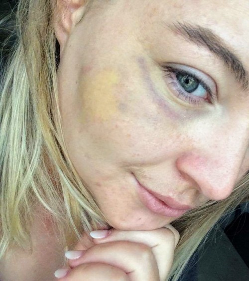 worshipandplease: Used her pretty hard, several punches to the face untill she cried… Glad to