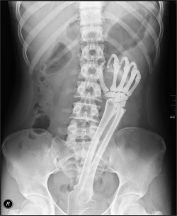 Rare X-Ray Shot Of Hotkinkyjo !