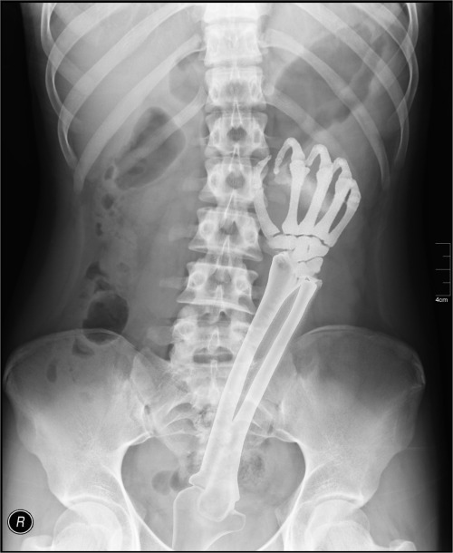 Rare x-ray shot of Hotkinkyjo ! adult photos