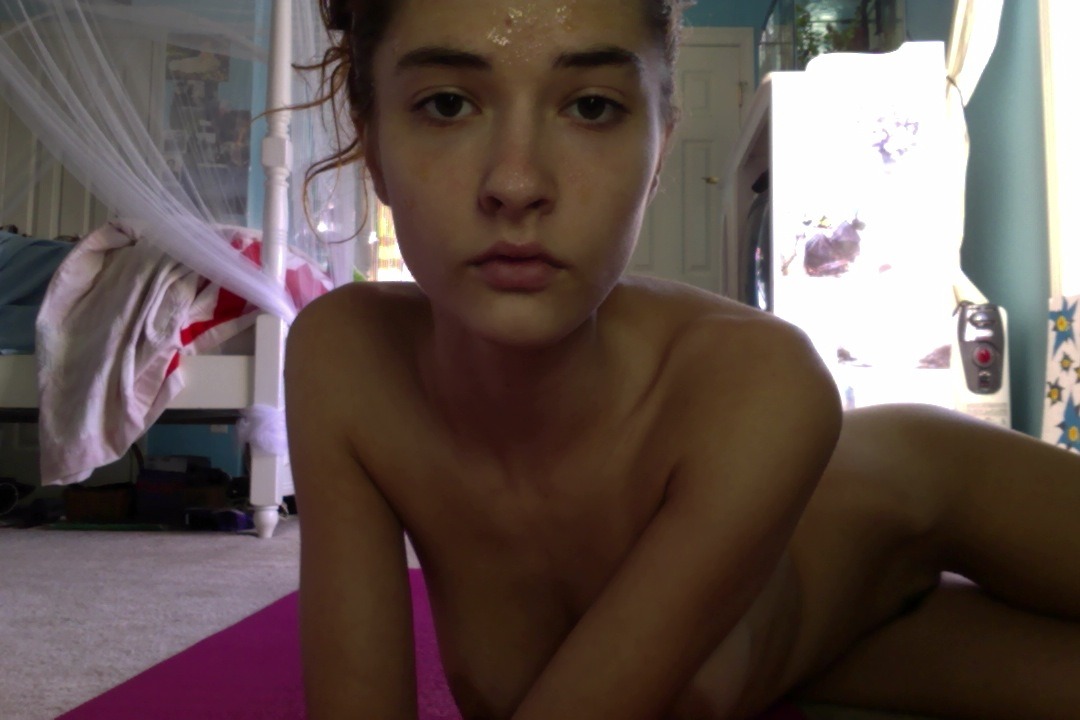 pure honey acne treatment Please only reblog with caption intact.