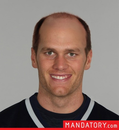 What if NFL QBs were bald