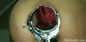 Fist is inside