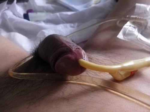 Porn Catheter lovers photos
