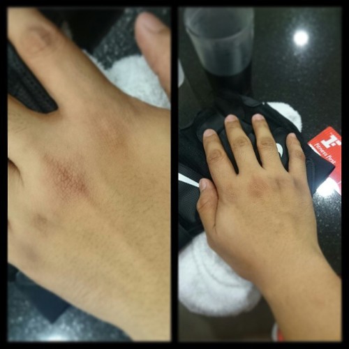 🎶"I have two hands, the left and the right. Hold them up so high and #punch with might. #Punch it forcefully one two three.   Look at both hands with bruises on it" 🎶   👊#muaythai 👊#training 👊#nopainnogain 👊#ouch