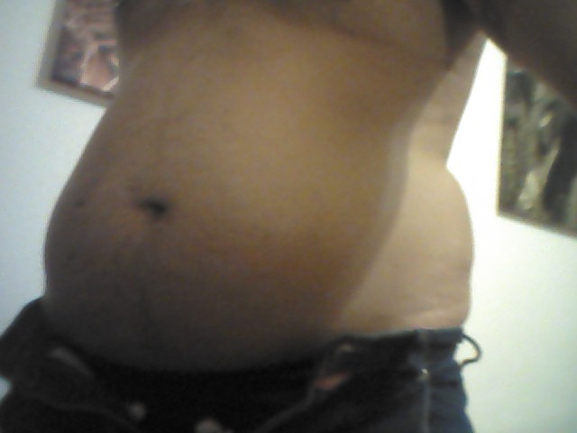 feedmealive:  See what overeating do! Â First picture is an old one and all the