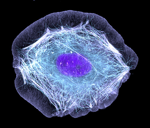 A human HaCat keratinocyte responds to epidermal growth factor by rapidly forming a lamellipod aroun