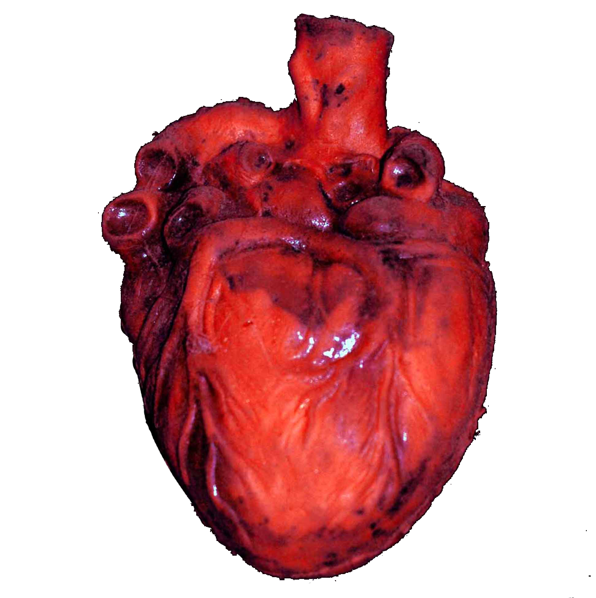 transparensies:anatomical hearts i