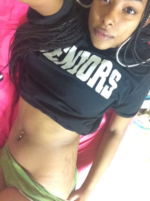 swallowyosoul:  My tummy is getting a little smaller ! And my stretch marks are being rude