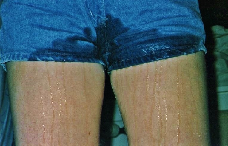 FEMALE DESPERATION ACCIDENTS