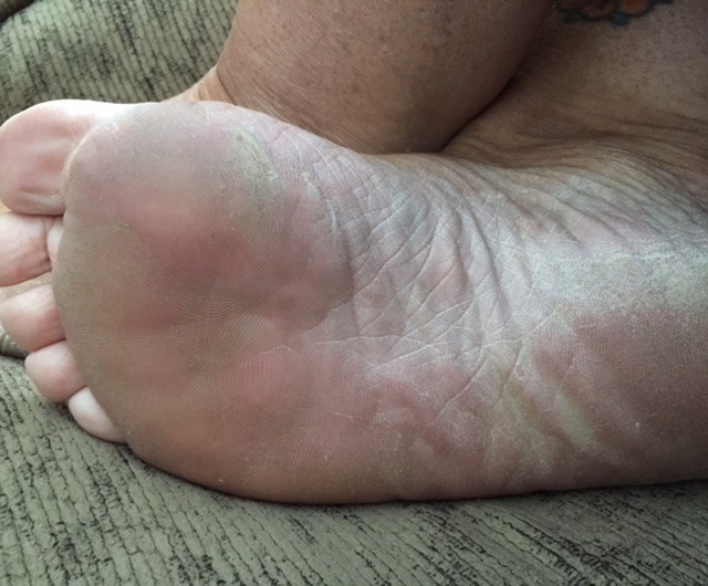 roughsoles:  38 y/o BBW milf.