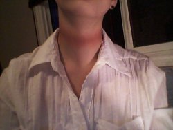 happy-for-hell:  cancerfreak69:  So, last night, I was getting ready to go out with my boyfriend to a dance at my school (which was cancelled due to lack of ticket sales) and, I had a nice black vest and a nice white shirt, and my uncle had just came