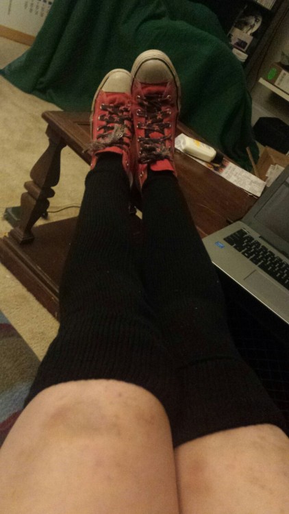 lesbianmisogynist: littlefeministbitch:Can’t go wrong with chucks, thigh highs, and bruises. I